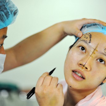 Still from JOLIN: The Evolution of my Life. A plastic surgeon, in a surgical hat and mask, draws dotted lines in black marker on a young woman's face. The woman is looking up and out of the frame, as he tilts her head back.
