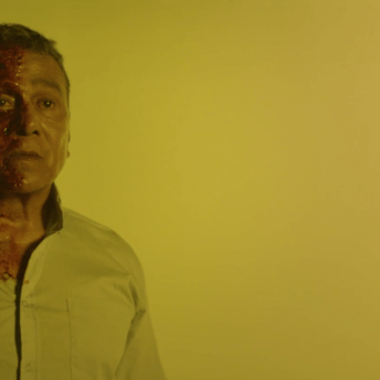 Still from #Mickey. An injured man is staring straight ahead. The right side of his face, neck, and shoulder/chest is burned. The background is a chartreuse color.