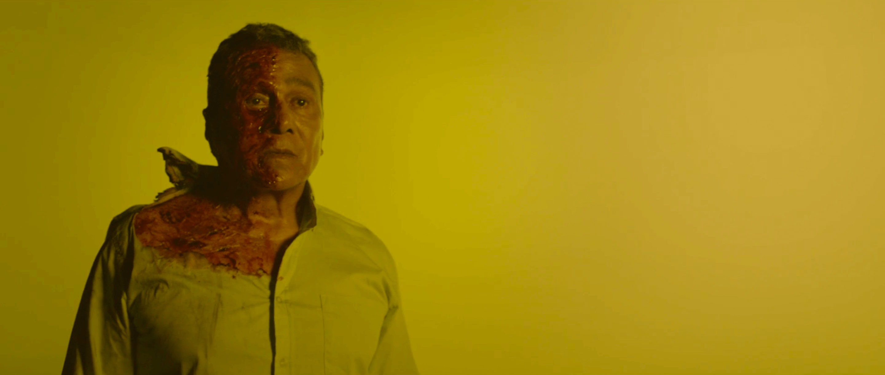 Still from #Mickey. An injured man is staring straight ahead. The right side of his face, neck, and shoulder/chest is burned. The background is a chartreuse color.