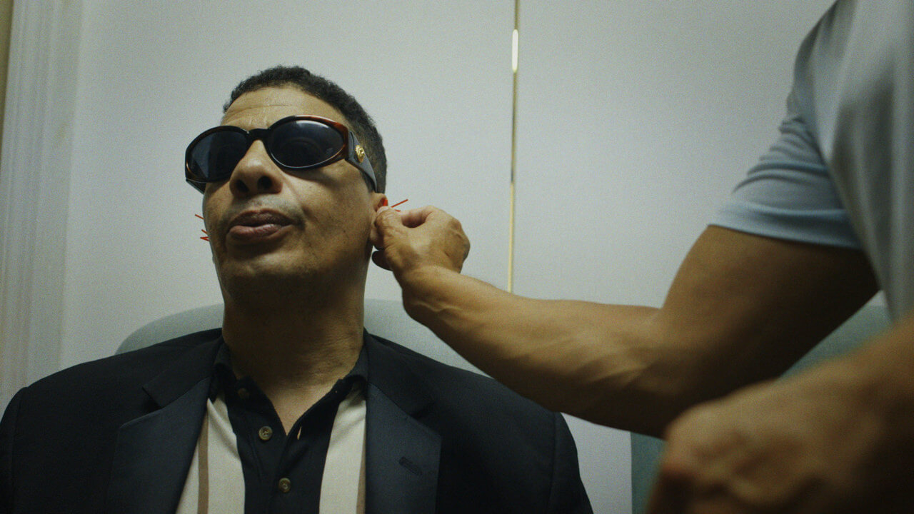 A man wearing sunglasses is receiving acupuncture treatment in his ear.